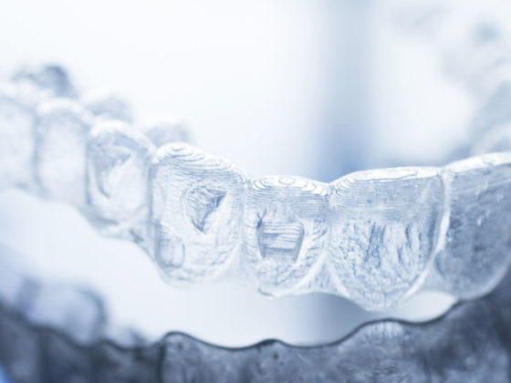 Apparecchio denti trasparente