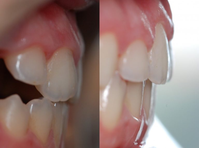 Ortodonzia 3 | Studio Dentistico a Magenta, Magnago, Milano