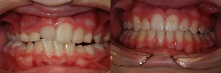 Ortodonzia 2 | Studio Dentistico a Magenta, Magnago, Milano