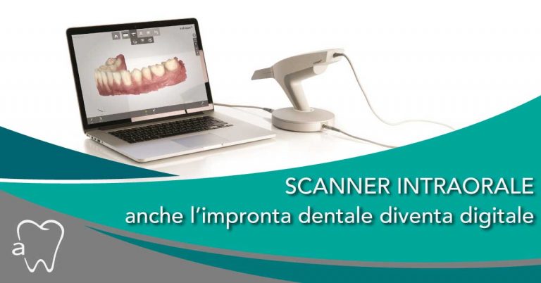 impronta dentale | Studio Dentistico Amadental