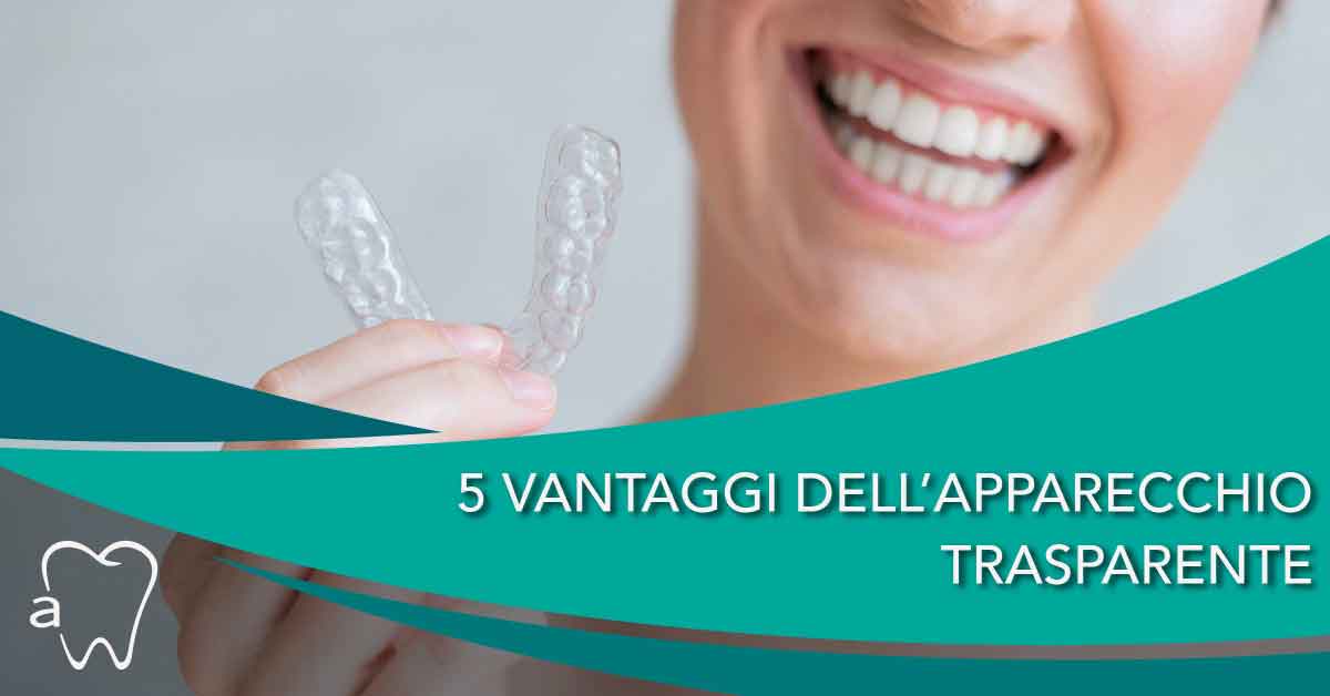 Apparecchio fisso trasparente: vantaggi e svantaggi - Dental Factor