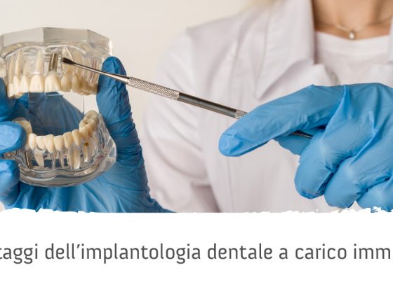 implantologia dentale a carico immediato vantaggi